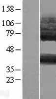 GPR105 (P2RY14) Human Over-expression Lysates NM_001081455