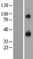 GPR105 (P2RY14) Human Over-expression Lysates NM_014879