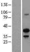MAFB Human Over-expression Lysates NM_005461