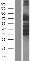 ARHGAP25 Human Over-expression Lysates NM_001166277