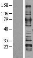 ARHGAP25 Human Over-expression Lysates NM_014882