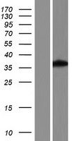 ENDOGL1 (EXOG) Human Over-expression Lysates NM_001145464