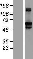 GFPT2 Human Over-expression Lysates NM_005110