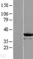 CRYZL1 Human Over-expression Lysates NM_145858