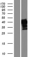 AMMECR1 Human Over-expression Lysates NM_015365
