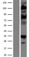 ls009958 usp15 human over expression lysates nm 006313 wb testing 1