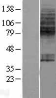 ls009963 slc23a1 human over expression lysates nm 152685 wb testing 1