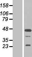 FGF19 Human Over-expression Lysates NM_005117