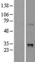 TL1A (TNFSF15) Human Over-expression Lysates NM_005118