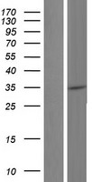 Constitutive androstane receptor (NR1I3) Human Over-expression Lysates NM_001077470