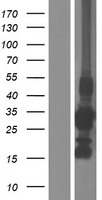 CCS Human Over-expression Lysates NM_005125