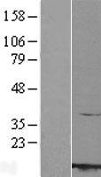 ROC1 (RBX1) Human Over-expression Lysates NM_014248