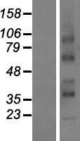RCE1 Human Over-expression Lysates NM_001032279