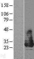 KCNE2 Human Over-expression Lysates NM_172201