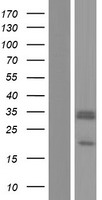 SCO2 Human Over-expression Lysates NM_001169109