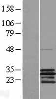 SCO2 Human Over-expression Lysates NM_005138
