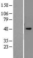 NR2E3 Human Over-expression Lysates NM_014249