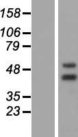 NR2E3 Human Over-expression Lysates NM_016346