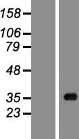 Acyl coenzyme A Thioesterase 8 (ACOT8) Human Over-expression Lysates NM_005469