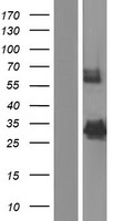 Acyl coenzyme A Thioesterase 8 (ACOT8) Human Over-expression Lysates NM_183386