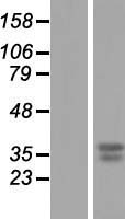GNPDA1 Human Over-expression Lysates NM_005471