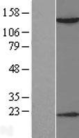 HDAC6 Human Over-expression Lysates NM_006044