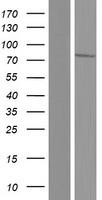 GLCNE (GNE) Human Over-expression Lysates NM_001190384