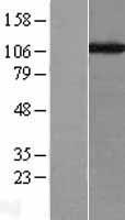 CAF1 (CHAF1A) Human Over-expression Lysates NM_005483