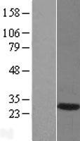 DNAJB6 Human Over-expression Lysates NM_005494