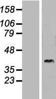 DNAJB6 Human Over-expression Lysates NM_058246