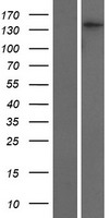 ls010051 smc4 human over expression lysates nm 001002800 wb testing 1