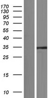 SAE1 Human Over-expression Lysates NM_001145713