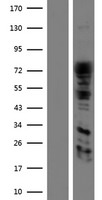 DRP1 (DNM1L) Human Over-expression Lysates NM_005690