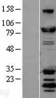 DRP1 (DNM1L) Human Over-expression Lysates NM_012062