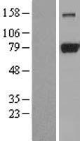 DRP1 (DNM1L) Human Over-expression Lysates NM_012063
