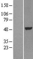 LXR alpha (NR1H3) Human Over-expression Lysates NM_005693