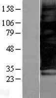 ls010067 scamp3 human over expression lysates nm 005698 wb testing 1