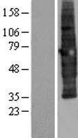 ls010067 scamp3 human over expression lysates nm 052837 wb testing 2