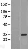 ls010068 il18bp human over expression lysates nm 173042 wb testing 1