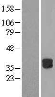 RWDD2B Human Over-expression Lysates NM_016940