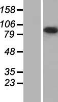 USH1C Human Over-expression Lysates NM_153676
