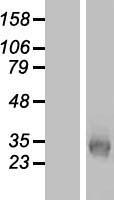 KCNK7 Human Over-expression Lysates NM_033347