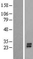 KCNK7 Human Over-expression Lysates NM_033348