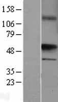 ls010090 uronyl 2 sulfotransferase ust human over expression lysates nm 005715 wb testing 1