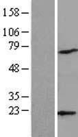 ls010093 arpc4 human over expression lysates nm 005718 wb testing 1