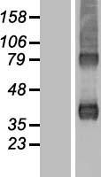 ls010095 arpc1b human over expression lysates nm 005720 wb testing 1