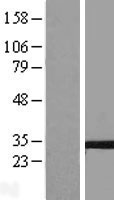 TSPAN5 Human Over-expression Lysates NM_005723