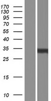 TSPAN3 Human Over-expression Lysates NM_001168412