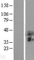 TSPAN3 Human Over-expression Lysates NM_005724