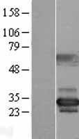 NUBP2 Human Over-expression Lysates NM_012225